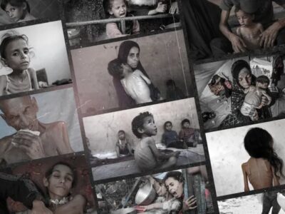 ادامه کابوس گرسنگی در غزه با پوشش آتش‌بس