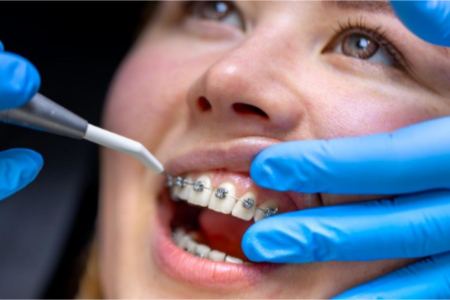 ارتودنسی ارتودنسی