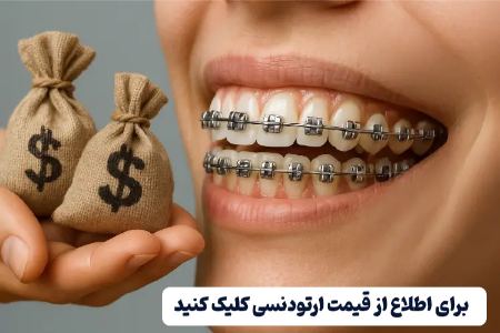 قیمت ارتودنسی قیمت ارتودنسی