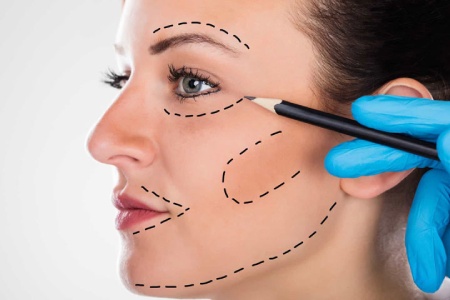 بهترین سن برای انجام لیفت صورت بهترین سن برای انجام لیفت صورت