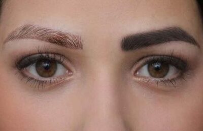 عوارض پاک کردن تاتو ابرو با لیزر {5 عوارض مهم و تجربی}