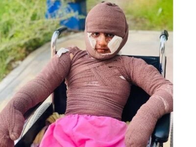 «هدا»، دختری از میناب/ مستندی درباره یکی از بازماندگان جنگ رمضان